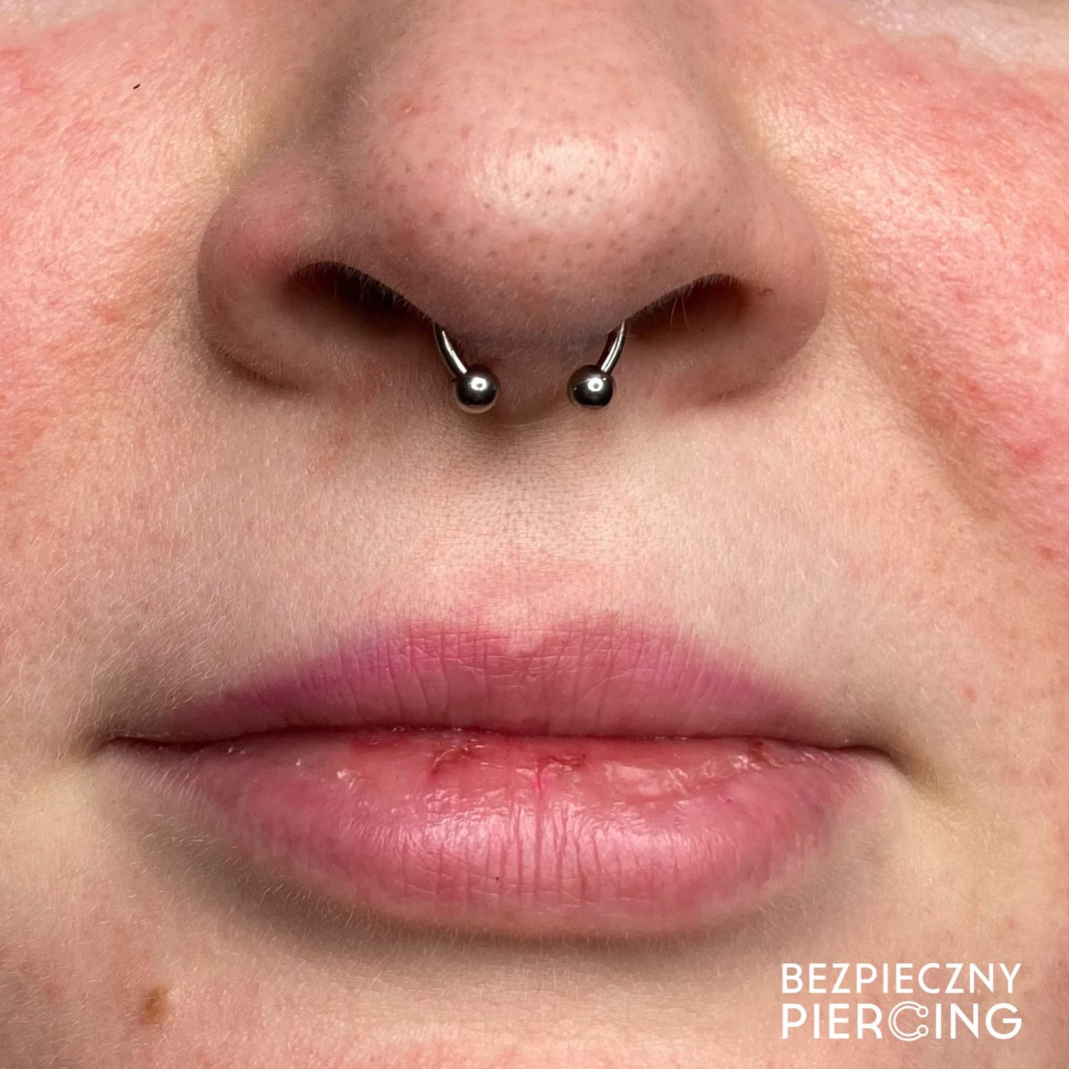 7sinstattoo.pl Zbliżenie dolnej części twarzy osoby, skupiające się na jej ustach i nosie, prezentujące piercing przegrody nosowej ozdobiony produktem 3C85E30B-74B7-446B-9610-4EEAC719D190 - kółkiem w kształcie podkowy z dwoma małymi kulkami na końcach. Skóra ma naturalną fakturę i kilka piegów. W prawym dolnym rogu pojawia się napis „BEZPIECZNY PIERCING”, wykonany przez najlepsze studio tatuażu Poznań. Najlepsze studio tatuażu Seven Sins Tattoo