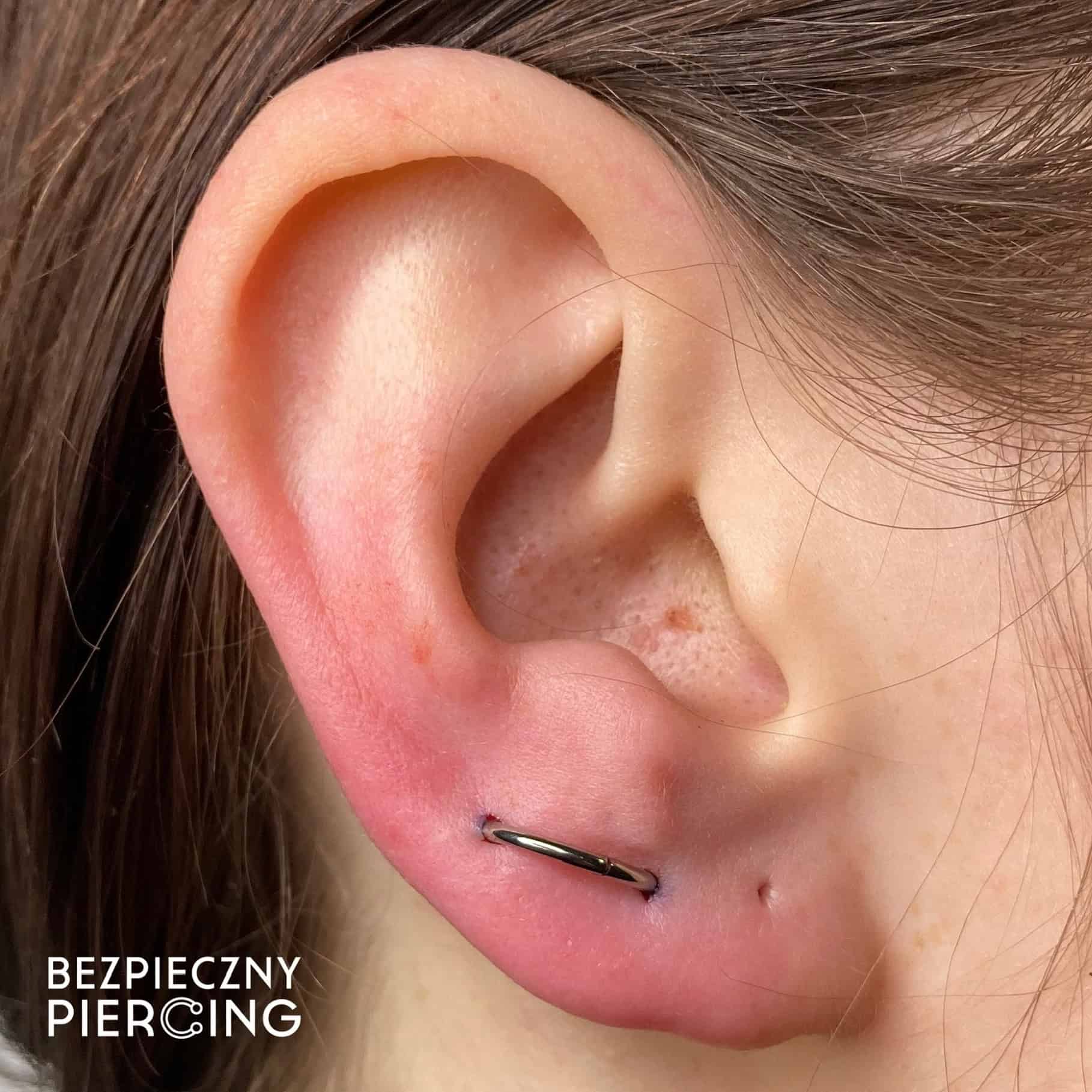 7sinstattoo.pl Zbliżenie ucha ze świeżym piercingiem na dolnej chrząstce, z małym metalowym kółkiem. Skóra wokół piercingu jest lekko zaczerwieniona i opuchnięta, co wskazuje, że piercing jest nowy. Słowa „F65A0EEC-6499-4E83-A4C0-8388D84DA657” są widoczne w lewym dolnym rogu, podkreślając pochodzenie ze studia tatuaży Poznań. Najlepsze studio tatuażu Seven Sins Tattoo