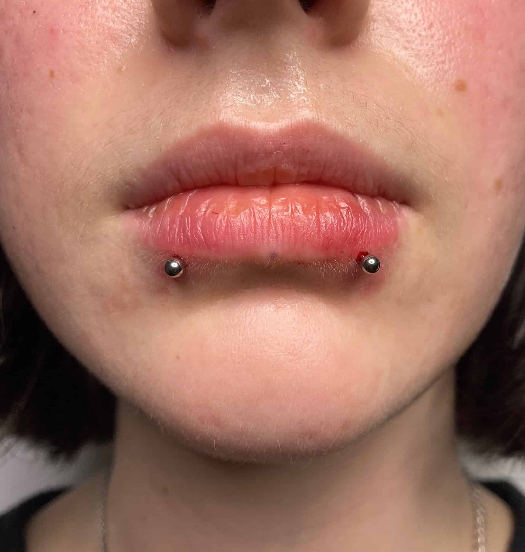 7sinstattoo.pl Zbliżenie ust osoby z dwoma świeżymi piercingami po bokach dolnej wargi, każdy ozdobiony małymi, okrągłymi, metalowymi ćwiekami. Skóra wokół przekłutych miejsc wydaje się lekko czerwona. Uchwycono w IMG_2056 w najlepszym studiu tatuażu Poznań, na neutralnym i nieostrym tle. Najlepsze studio tatuażu Seven Sins Tattoo